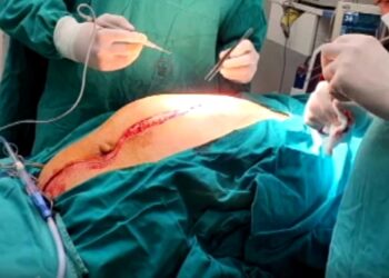 Veliki uspeh lekara Urgentnog centra: Odstranili tumor težak 50 kilograma