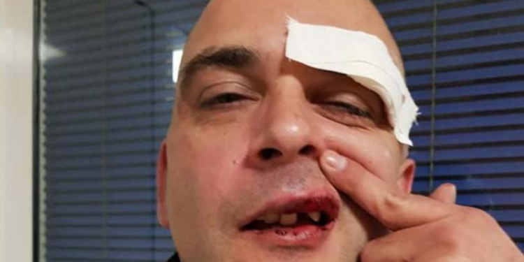 Brutalnost bez kazne – Beograđanin Ilija Vučević nova žrtva homofobije