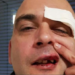 Brutalnost bez kazne – Beograđanin Ilija Vučević nova žrtva homofobije