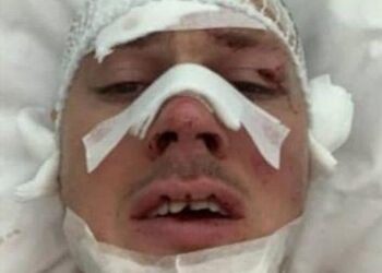 Drama bivšeg fudbalera Partizana: Jedva su mi spasili jezik, imam krvarenje u mozgu, iz Humske me nisu zvali