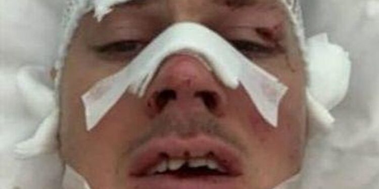 Drama bivšeg fudbalera Partizana: Jedva su mi spasili jezik, imam krvarenje u mozgu, iz Humske me nisu zvali
