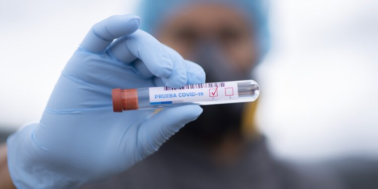 Dokazano 149 oboljenja britanskim sojem