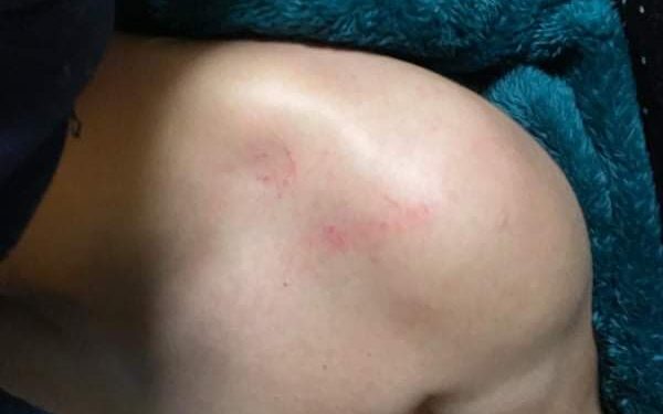 Prekomerna primena sile policije nad Srbima (VIDEO)