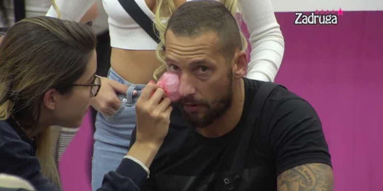 MC Damiro u alkoholisanom stanju nasrnuo na Dina Dizdarevića i pogodio ga flašom u oko (VIDEO)
