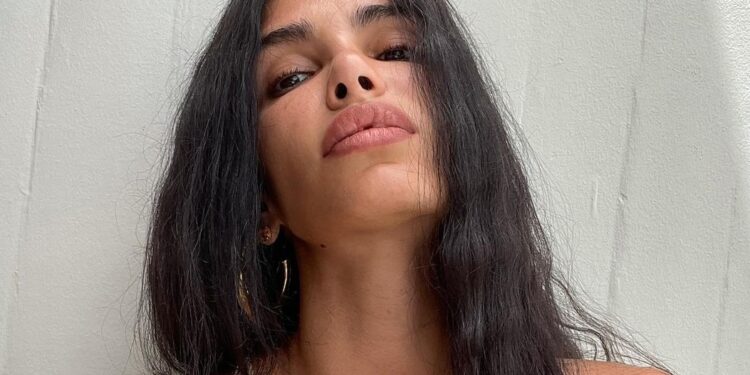 Jovana Đorđević prolazi kroz pakao zbog korekcije usana (FOTO)