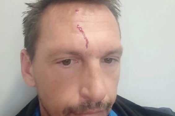 Tuča u Veslačkom savezu Srbije: Nikola Stojić završio u Urgentnom centru