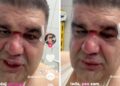 Saša Mirković se oglasio posle brutalnog prebijanja u Zagrebu: Niko iz hotela nije izašao (VIDEO)