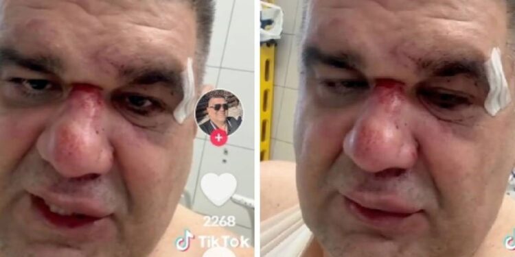 Saša Mirković se oglasio posle brutalnog prebijanja u Zagrebu: Niko iz hotela nije izašao (VIDEO)