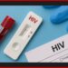 Budjenje svesti: Nažalost HIV otkrivaju tek kada je kasno